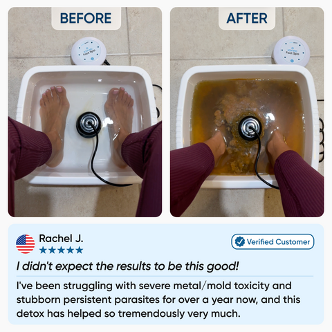 Pure Detox Ionic Foot Spa | Remove Toxins and Heavy Metals for a Healthier Life